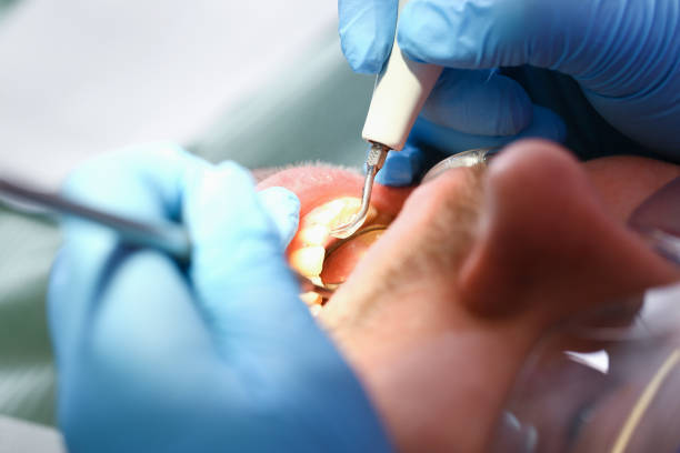 Best Emergency Broken Tooth Repair in Algoma, WI