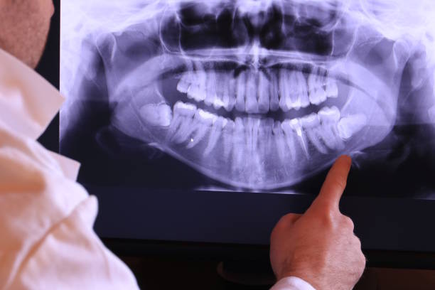 Best Emergency Tooth Extraction in Algoma, WI